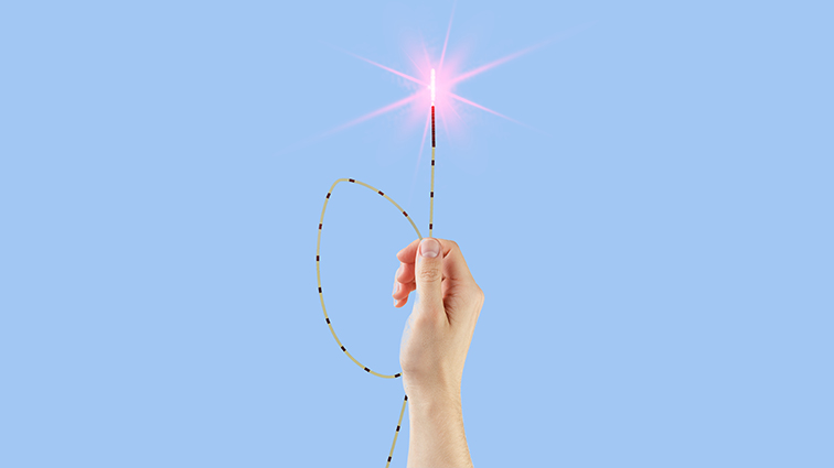 laser SiLaC